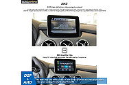 Mercedes Benz A Class B Class GLA Wireless CarPlay Android Auto Smart Module Carstereo Carplay dab 